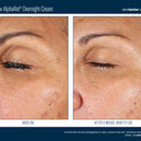 EyeMax™ AlphaRet® Overnight Cream