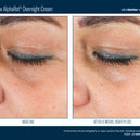 EyeMax™ AlphaRet® Overnight Cream