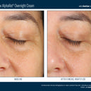 EyeMax™ AlphaRet® Overnight Cream