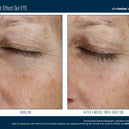 Instant Effect Gel EYE 15ml