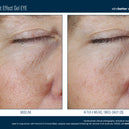 Instant Effect Gel EYE 15ml