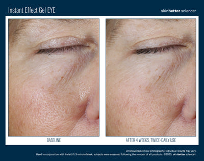 Instant Effect Gel EYE 15ml