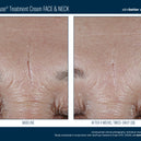 InterFuse® Treatment Cream FACE & NECK