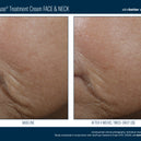 InterFuse® Treatment Cream FACE & NECK