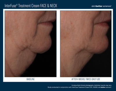 InterFuse® Treatment Cream FACE & NECK
