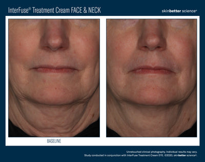 InterFuse® Treatment Cream FACE & NECK