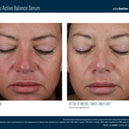 Mystro™ Active Balance Serum