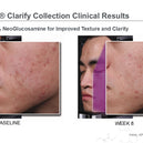 NEOSTRATA® Clarify Gel Plus