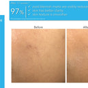 NEOSTRATA® Clarify Post-Acne Mark Correcting Serum