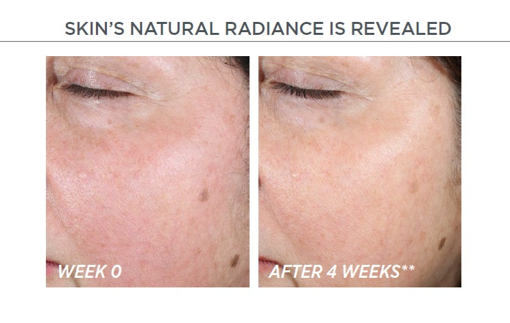 Restore PHA Renewal Pads – AestheticSource