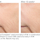Vitamin C Lotion 30%