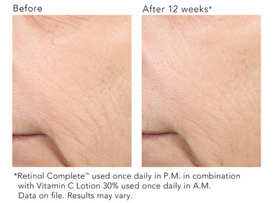 Vitamin C Lotion 30%