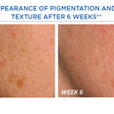 Resurface Smooth Surface Glycolic Peel