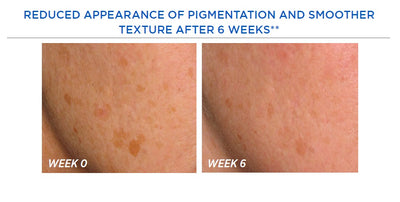 Resurface Smooth Surface Glycolic Peel