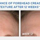 Resurface Smooth Surface Glycolic Peel