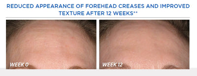 Resurface Smooth Surface Glycolic Peel