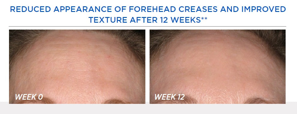 NEOSTRATA® Resurface Smooth Surface Glycolic Peel