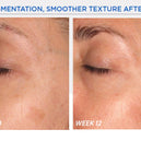 Resurface Smooth Surface Glycolic Peel