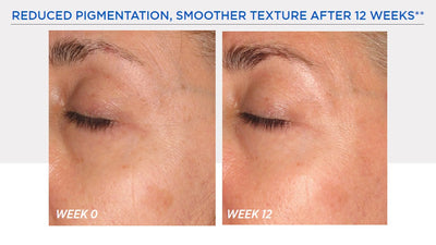 Resurface Smooth Surface Glycolic Peel