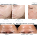 NEOSTRATA® ProSystem Retinol Peel 12 vials 1.5ml