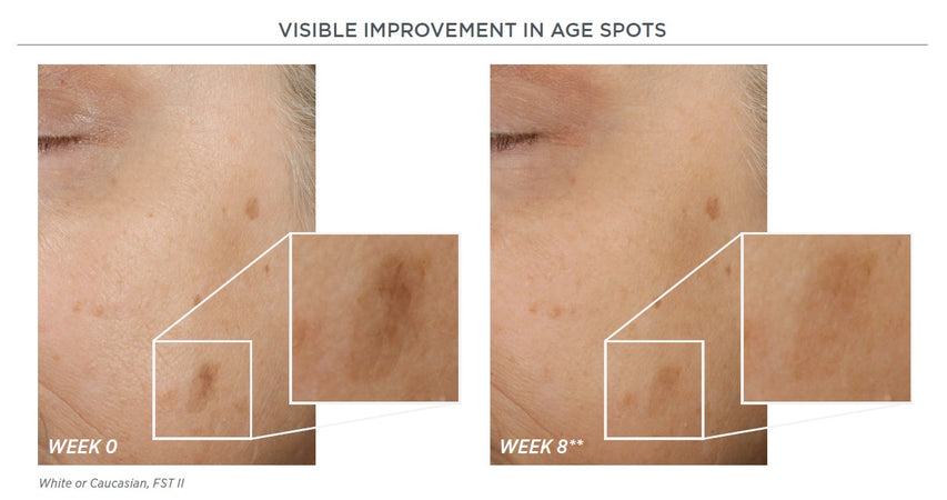NEOSTRATA® Skin Active Potent Retinol Complex 30ml
