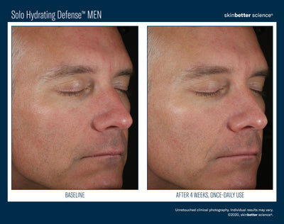 Solo Hydrating Defense™ Serum MEN