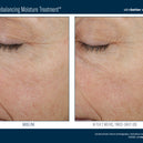 Trio Rebalancing Moisture Treatment™