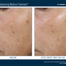 Trio Rebalancing Moisture Treatment™