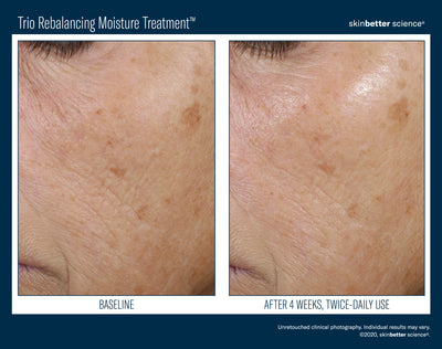 Trio Rebalancing Moisture Treatment™