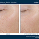 Trio Rebalancing Moisture Treatment™