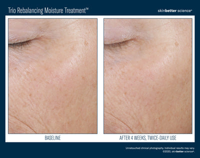 Trio Rebalancing Moisture Treatment™