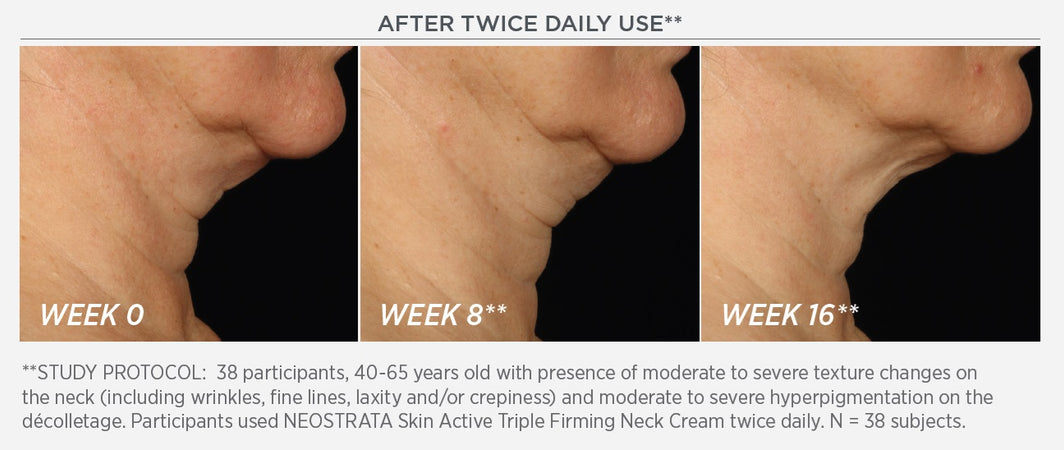 NEOSTRATA® Skin Active Triple Firming Neck Cream With MicroDiPeptide229®
