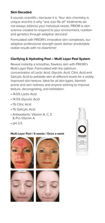 PRIORI® Skincare Peel Brochure (4 pages)