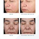 skinbetter science® Alto Advanced Defense & Repair Serum Patient Pamphlet (4 pages)