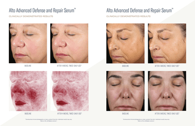 skinbetter science® Alto Advanced Defense & Repair Serum Sales Aid (12 pages)